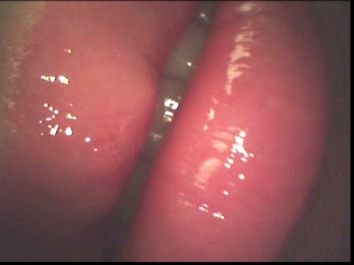 LIA-205/77lia00205のティザービジュアル1