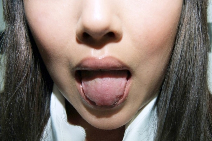 OL-182/h_113ol00182のティザービジュアル2