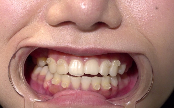 AD-128/h_1416ad00128のティザービジュアル1