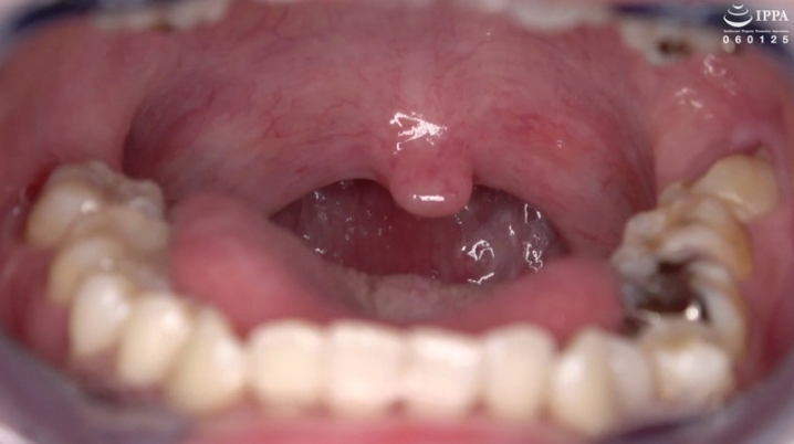 AD-1536/h_1416ad01536のメインビジュアル