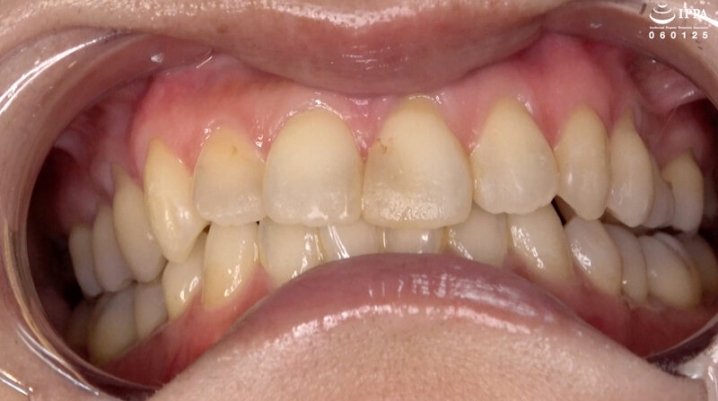 AD-1840/h_1416ad01840のティザービジュアル2