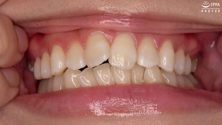 AD-2042/h_1416ad02042のティザービジュアル2