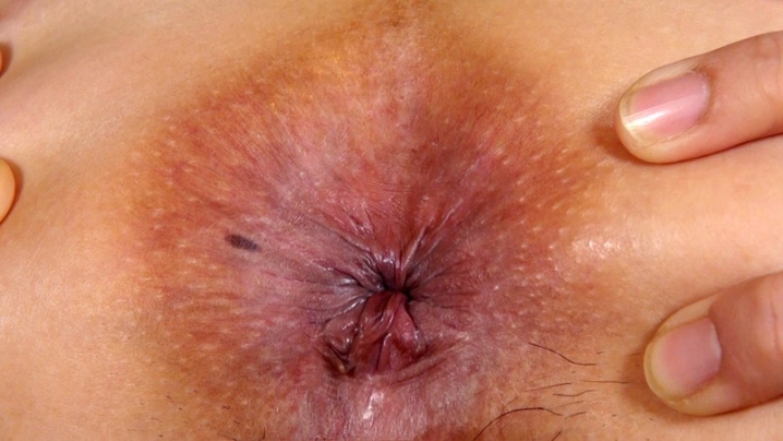 ODV-402/odv00402のキービジュアル